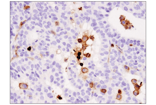 Immunohistochemistry Image 4: Coronin 1A (D6K5B) Rabbit Monoclonal Antibody