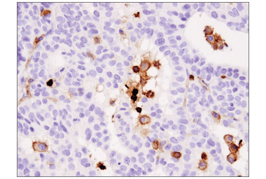 Immunohistochemistry Image 4: Coronin 1A (D6K5B) XP<sup>®</sup> Rabbit mAb