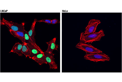 NKX3.1 (D2Y1A) XP® Rabbit mAb | Cell Signaling Technology