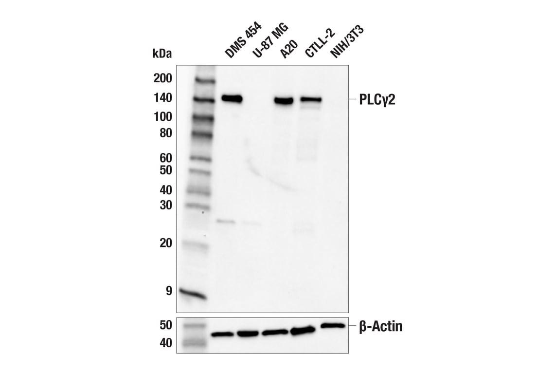 Western Blotting Image 1: PLCγ2 (F9L8Z) Rabbit mAb