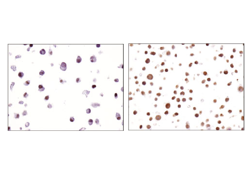 undefined Image 22: PBAF Complex Antibody Sampler Kit
