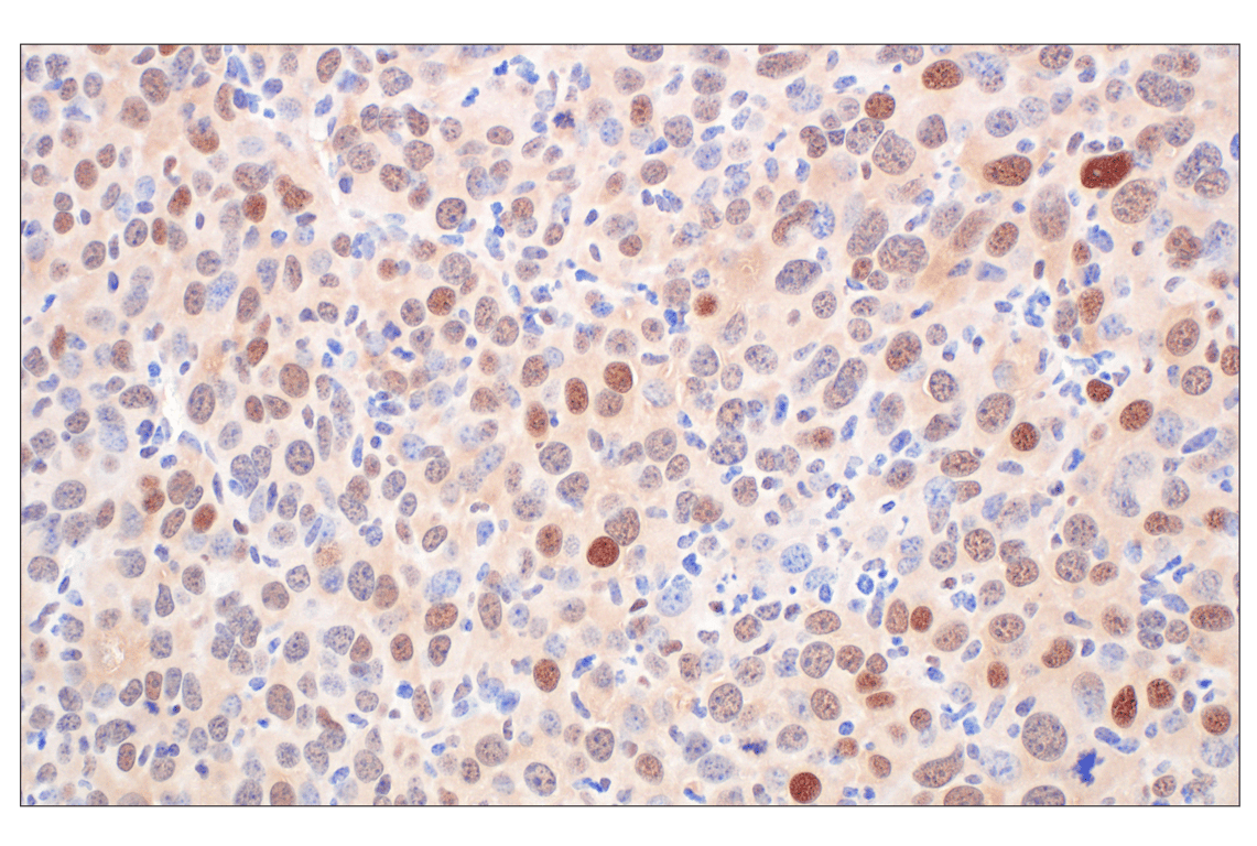 Immunohistochemistry Image 10: CDK4 (F8L5F) Rabbit Monoclonal Antibody