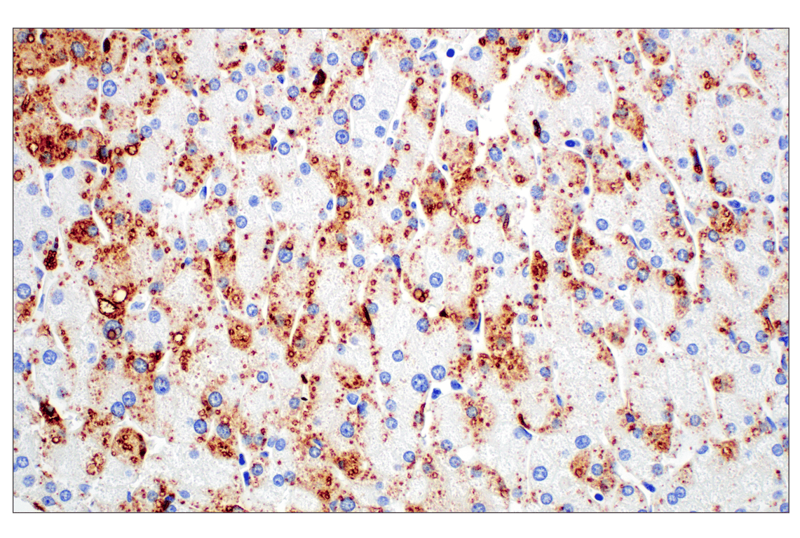 Immunohistochemistry Image 14: Perilipin-2 (E6G6M) Rabbit Monoclonal Antibody