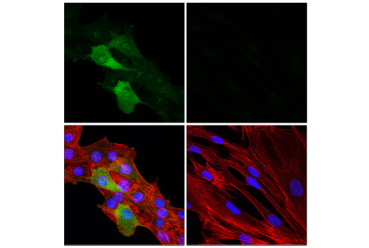 Immunofluorescence Image 1: NDRG1 (E2T5I) Rabbit Monoclonal Antibody