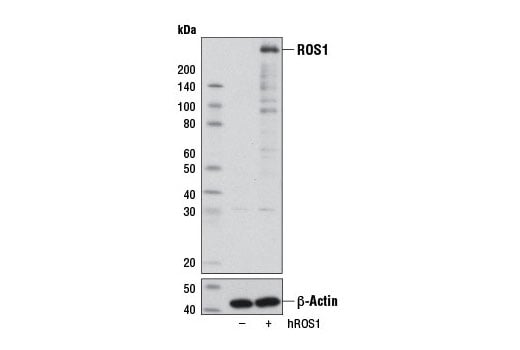 Western Blotting Image 2: ROS1 (D4D6) Rabbit Monoclonal Antibody