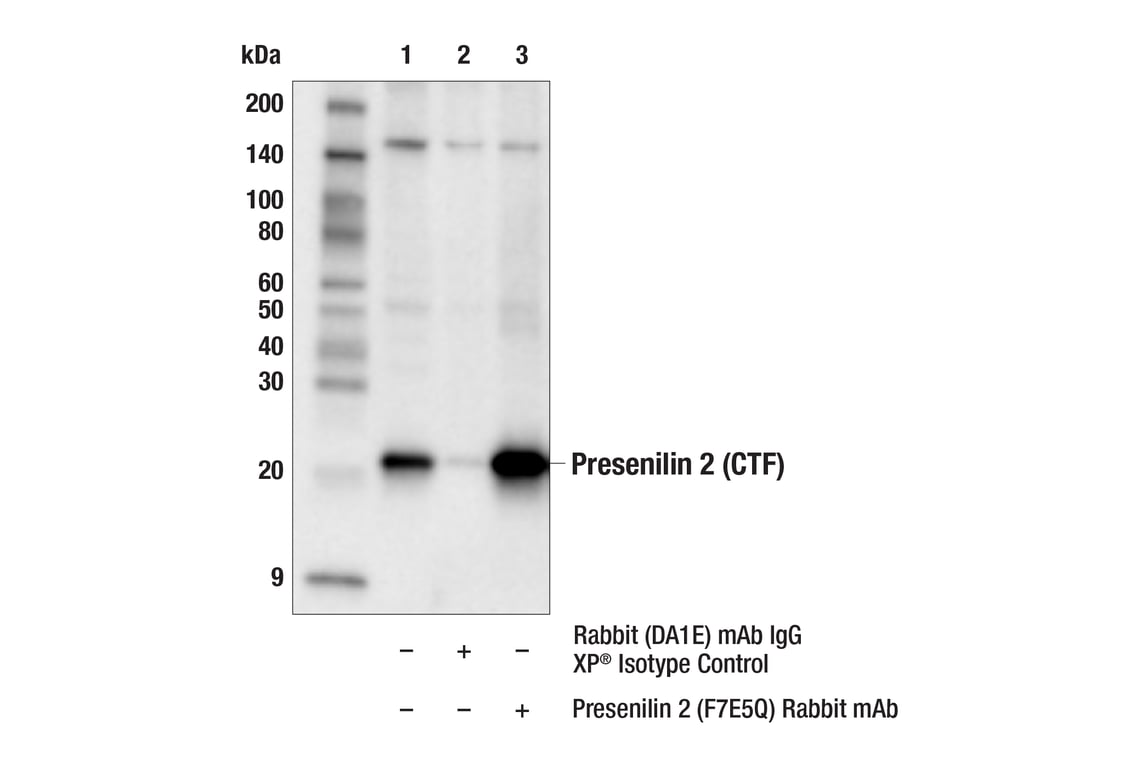 Immunoprecipitation Image 1: Presenilin 2 (F7E5Q) Rabbit Monoclonal Antibody