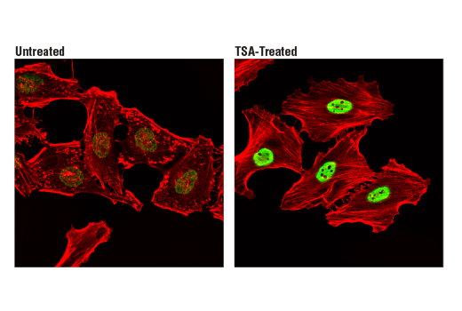 Immunofluorescence Image 1: Acetyl-Histone H2B (Lys20) (D7O9W) Rabbit Monoclonal Antibody