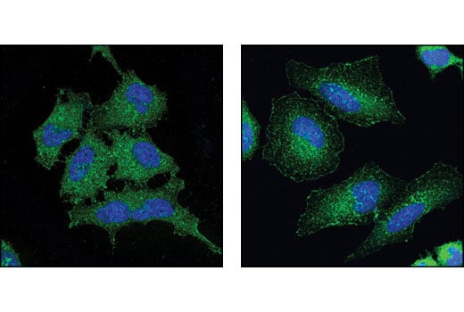 Immunofluorescence Image 1: WAVE-2 (D2C8) XP<sup>®</sup> Rabbit mAb