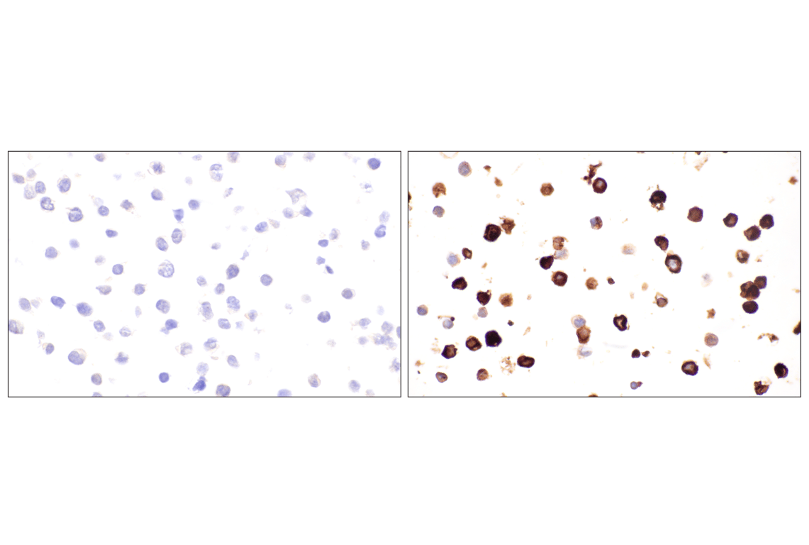 Immunohistochemistry Image 10: DPEP-1/MDP (E5H7T) Rabbit Monoclonal Antibody