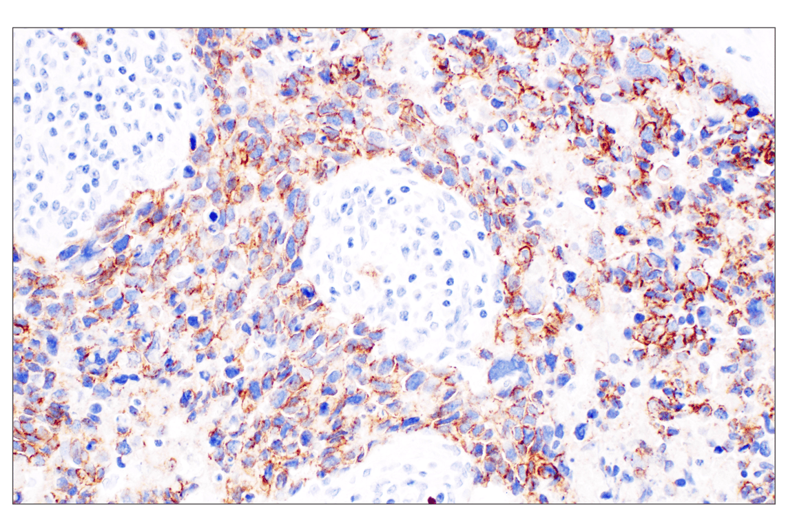 Immunohistochemistry Image 1: P-Cadherin (C13F9) Rabbit Monoclonal Antibody