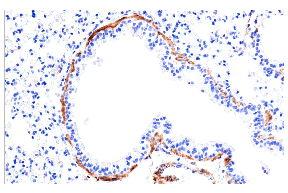 Immunohistochemistry Image 10: MYH11 (E4N8M) Rabbit Monoclonal Antibody (BSA and Azide Free)