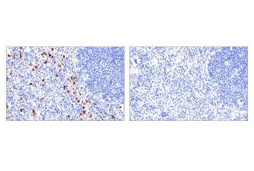 Immunohistochemistry Image 1: NK1.1/CD161 (E6Y9G) Rabbit Monoclonal Antibody