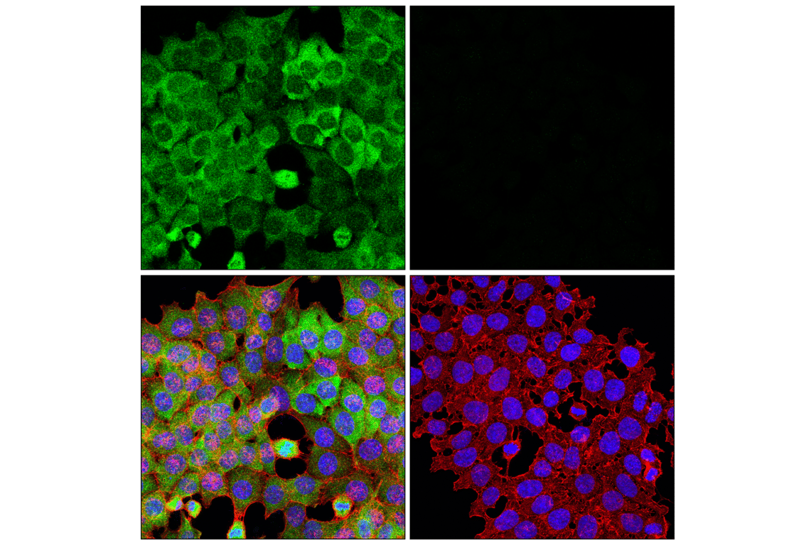 Immunofluorescence Image 1: SPAK (F7T1K) Rabbit Monoclonal Antibody