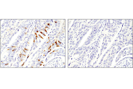Immunohistochemistry Image 4: MTSS1 (D2H4L) Rabbit Monoclonal Antibody