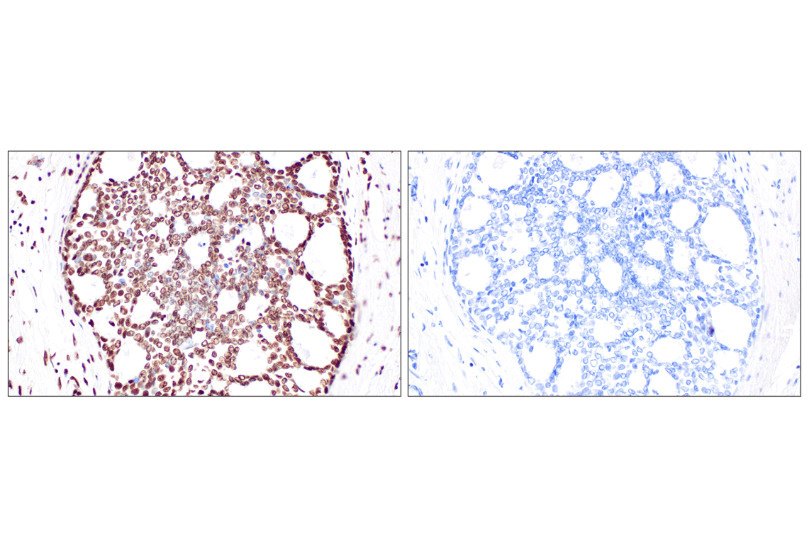 Immunohistochemistry Image 10: NPM1 (E7W4P) Rabbit Monoclonal Antibody