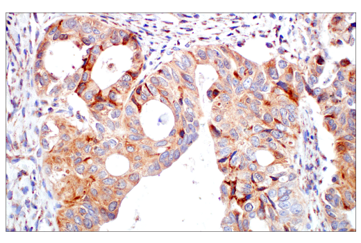Immunohistochemistry Image 2: DHFR (E6L1H) Rabbit Monoclonal Antibody