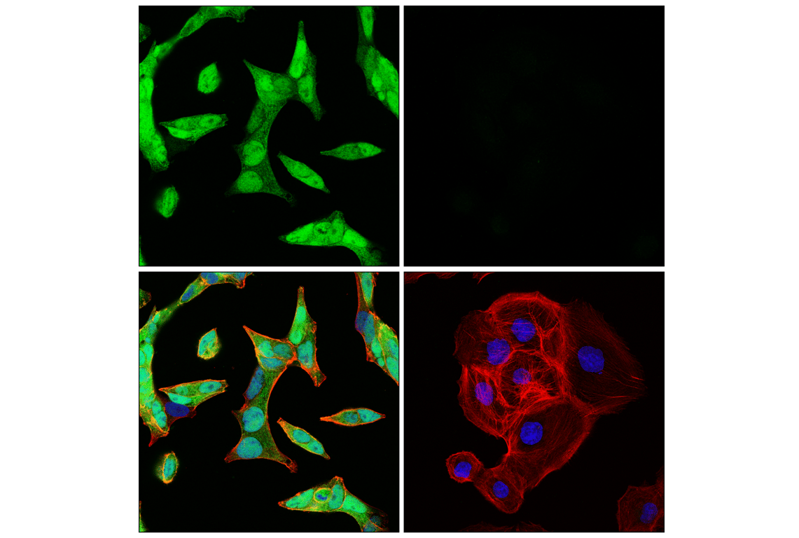 Immunofluorescence Image 1: Androgen Receptor (E3S4N) Rabbit Monoclonal Antibody (Carboxy-terminal Antigen)
