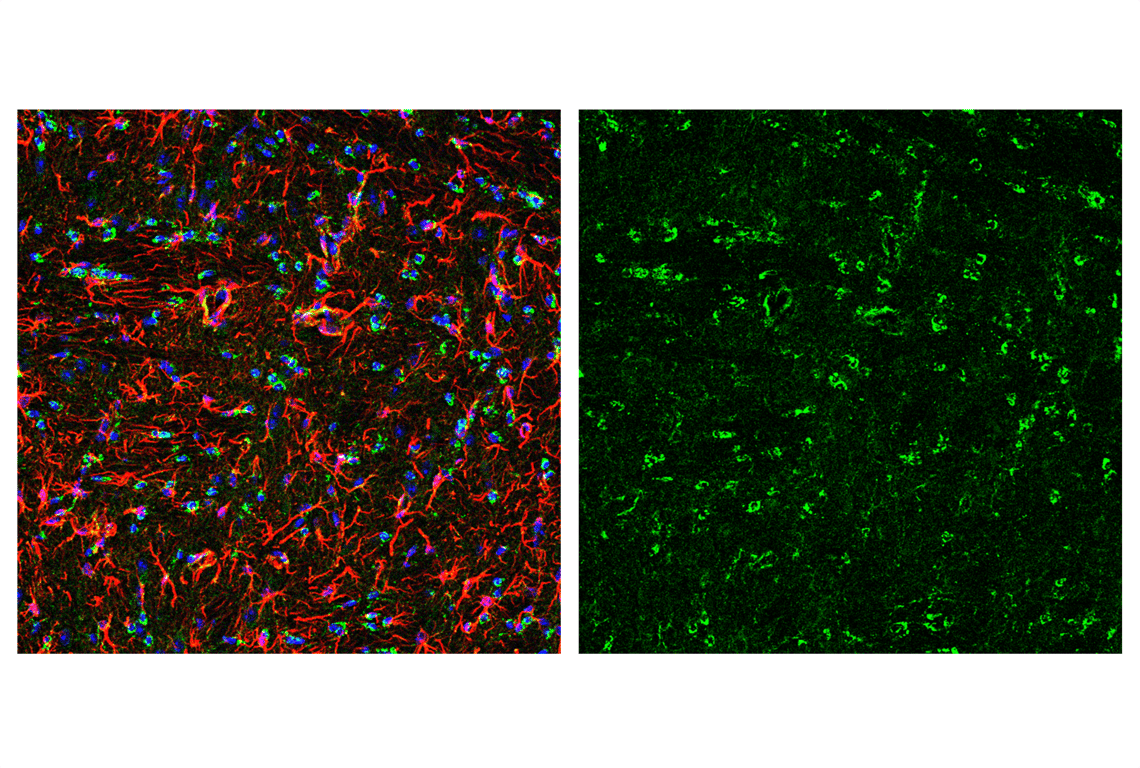 Immunofluorescence Image 4: Smac/Diablo (D5S3R) Rabbit Monoclonal Antibody