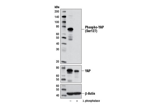 Western Blotting Image 2: Phospho-YAP (Ser127) (D9W2I) Rabbit Monoclonal Antibody (BSA and Azide Free)