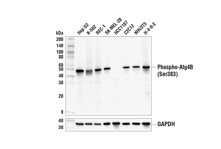 Western Blotting Image 2: Phospho-Atg4B (Ser383) (E3I8M) Rabbit Monoclonal Antibody