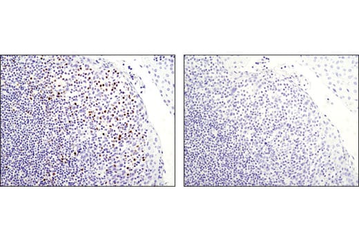 Immunohistochemistry Image 4: T-bet/TBX21 (D6N8B) Rabbit Monoclonal Antibody