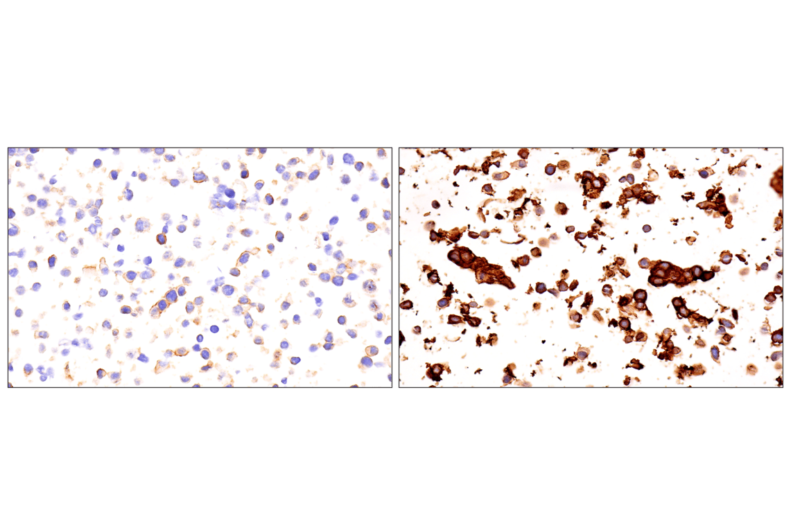 Immunohistochemistry Image 10: SCARB1 (E9H4F) Rabbit Monoclonal Antibody