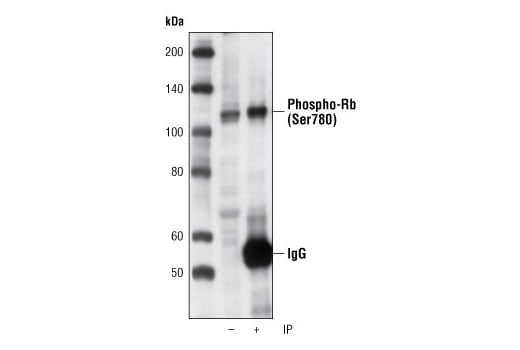 Immunoprecipitation Image 1: Phospho-Rb (Ser780) (C84F6) Rabbit Monoclonal Antibody