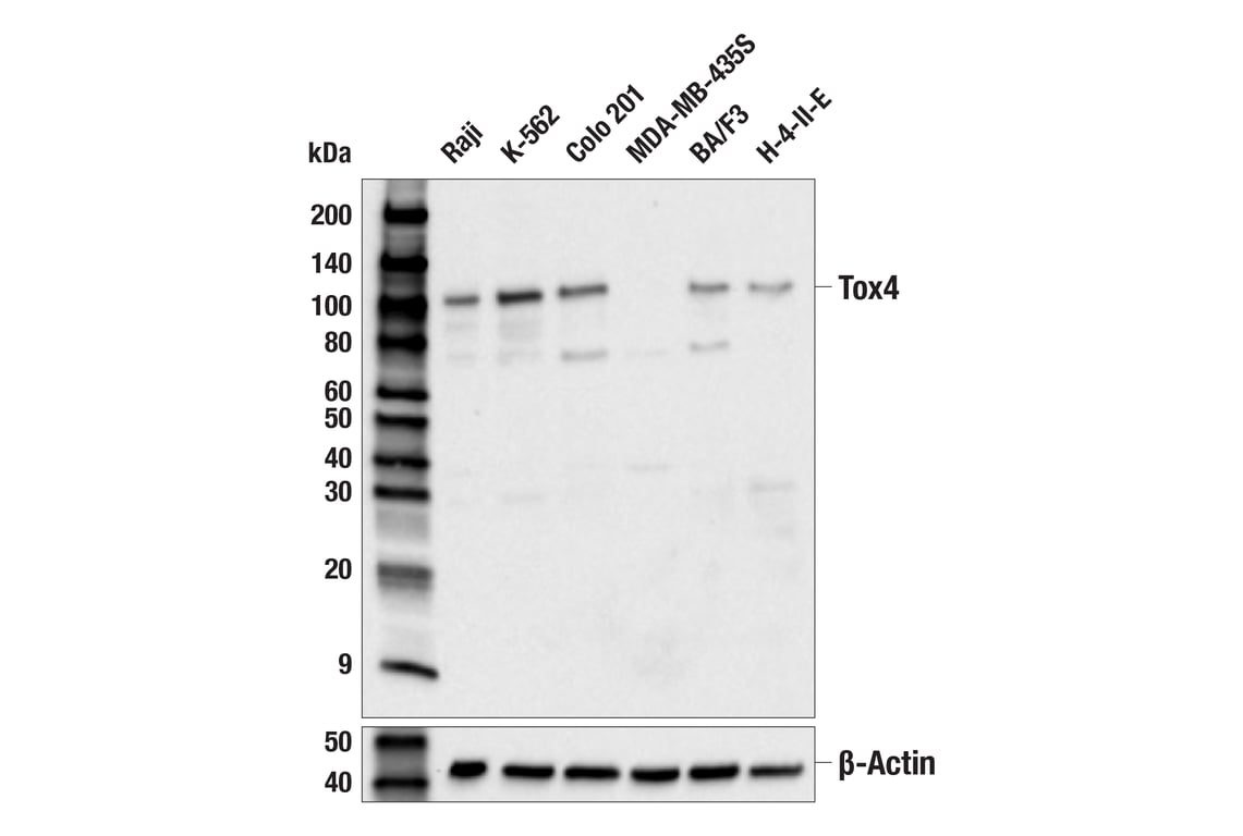 Western Blotting Image 1: Tox4 (E9U3L) Rabbit mAb