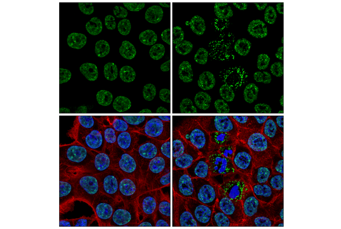 Immunofluorescence Image 1: Matrin 3 (F4Q5F) Rabbit Monoclonal Antibody