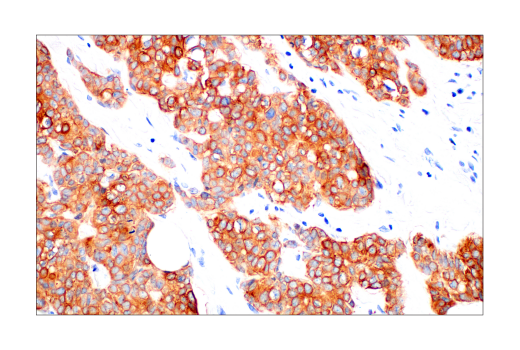 Immunohistochemistry Image 2: Pan-Keratin (AE1/AE3) Mouse mAb