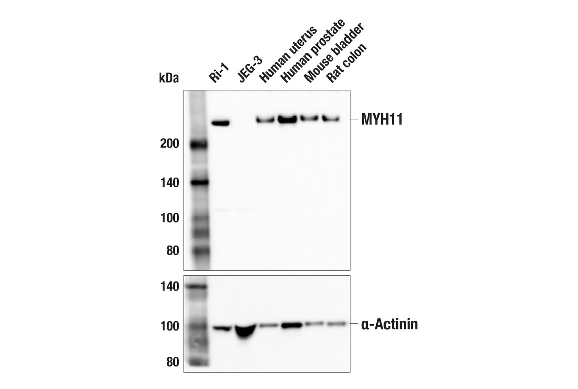 Western Blotting Image 2: MYH11 (E4Q4L) Rabbit Monoclonal Antibody
