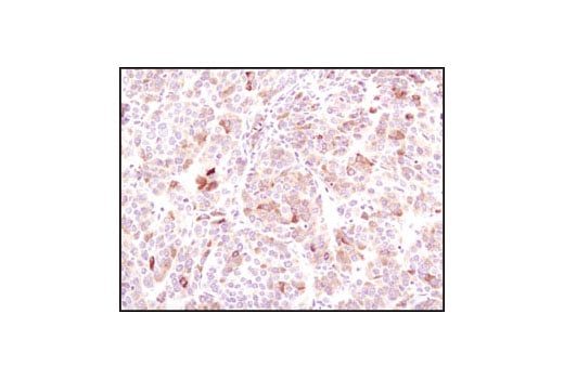 Immunohistochemistry Image 2: BiP (C50B12) Rabbit Monoclonal Antibody (BSA and Azide Free)