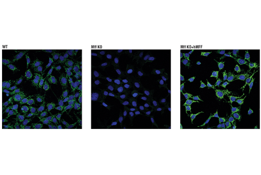 Immunofluorescence Image 1: MFF (E5W4M) XP<sup>®</sup> Rabbit mAb
