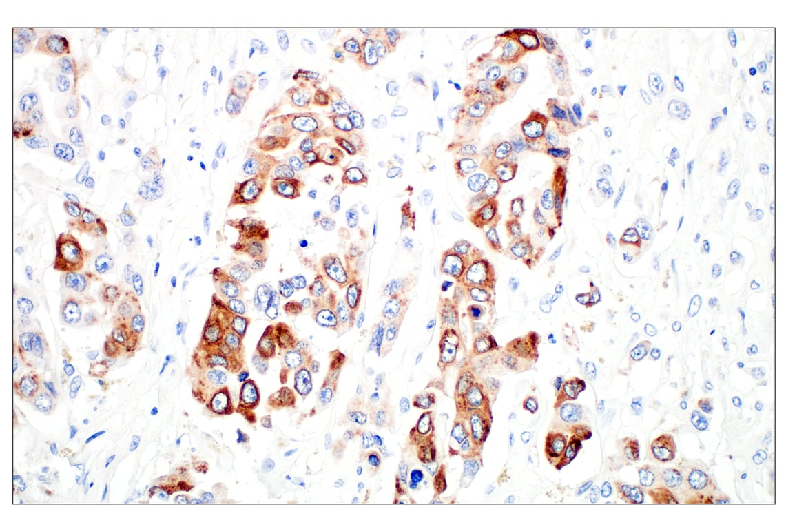 Immunohistochemistry Image 2: LPCAT1 (E4V4B) Rabbit Monoclonal Antibody (BSA and Azide Free)