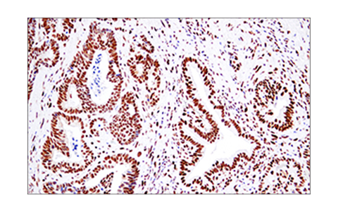 Immunohistochemistry Image 2: 53BP1 (E7N5D) XP<sup>®</sup> Rabbit mAb