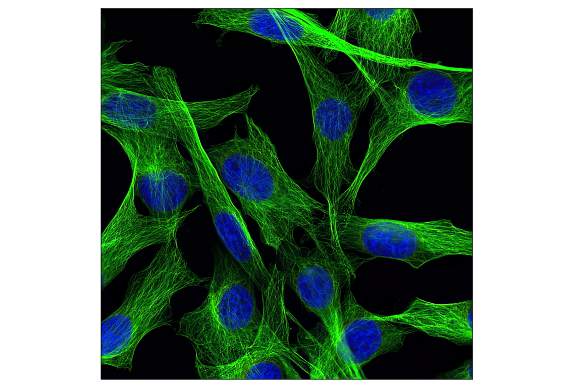 Immunofluorescence Image 1: beta-Tubulin (D2N5G) Rabbit Monoclonal Antibody