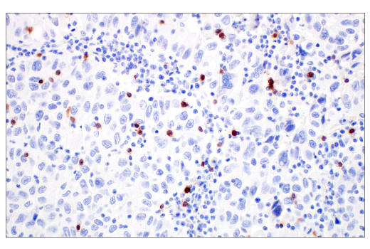Immunohistochemistry Image 3: TRDC/TCR delta (E2E9T) Rabbit Monoclonal Antibody (BSA and Azide Free)