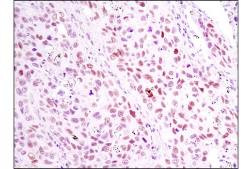 Immunohistochemistry Image 2: RAR gamma1 (D3A4) Rabbit Monoclonal Antibody