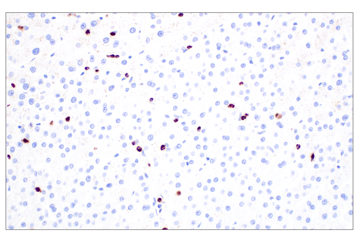 Immunohistochemistry Image 8: NKG7 (F4V5I) Rabbit Monoclonal Antibody (BSA and Azide Free)