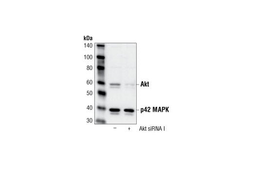 undefined Image 2: SignalSilence<sup>®</sup> Akt siRNA I