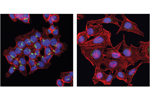 Immunofluorescence Image 1: FAM3C (D1S2D) Rabbit Monoclonal Antibody (BSA and Azide Free)