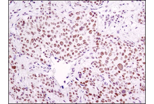 Immunohistochemistry Image 1: ERCC1 (D6G6) XP<sup>®</sup> Rabbit mAb