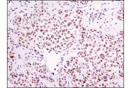 Immunohistochemistry Image 1: ERCC1 (D6G6) Rabbit Monoclonal Antibody