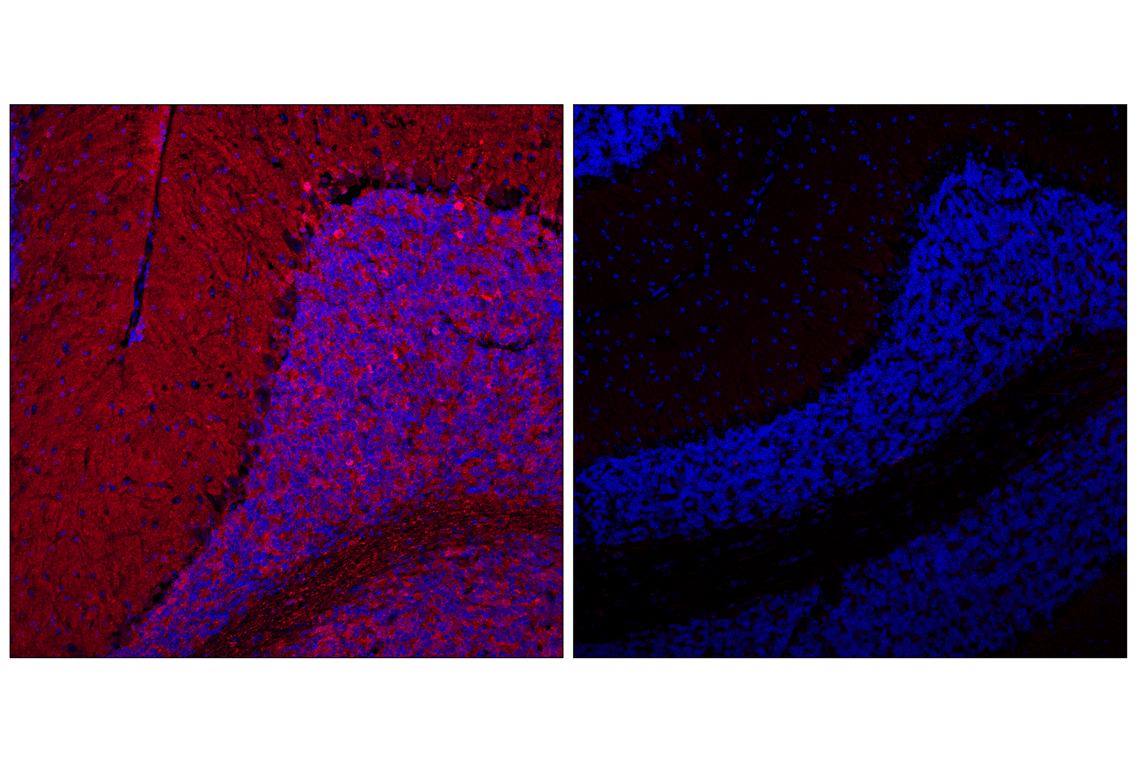 Immunofluorescence Image 1: Phospho-Tau (Ser202) (F2A2F) Rabbit Monoclonal Antibody