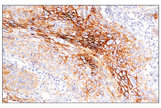 Immunohistochemistry Image 2: CD54/ICAM-1 (E3Q9N) Rabbit Monoclonal Antibody (BSA and Azide Free)