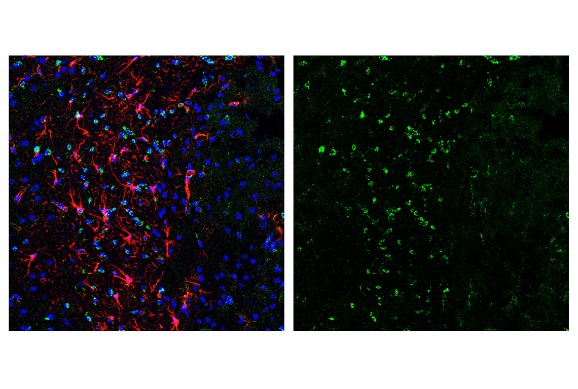 Immunofluorescence Image 3: Smac/Diablo (D5S3R) Rabbit Monoclonal Antibody