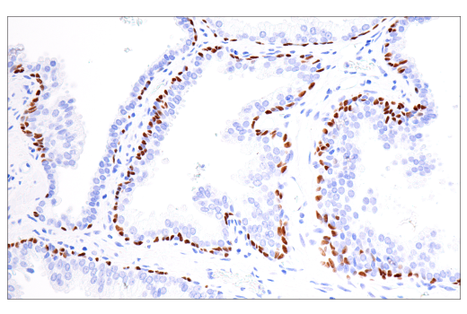 Immunohistochemistry Image 1: p40 (BC28) Mouse Monoclonal Antibody