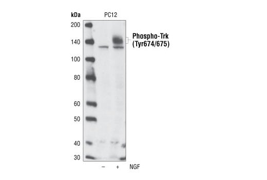 Western Blotting Image 2: Phospho-TrkA (Tyr674/675)/TrkB (Tyr706/707) (C50F3) Rabbit Monoclonal Antibody