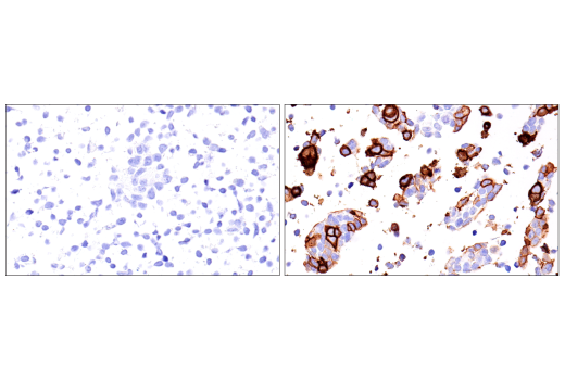 Immunohistochemistry Image 5: NK1.1/CD161 (E6Y9G) Rabbit Monoclonal Antibody (BSA and Azide Free)