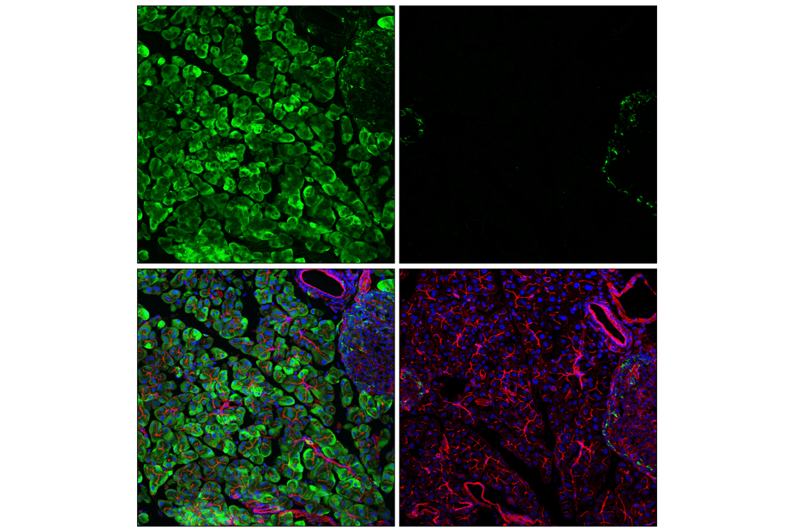 Immunofluorescence Image 2: Phospho-S6 Ribosomal Protein (Ser235/236) (D57.2.2E) Rabbit Monoclonal Antibody